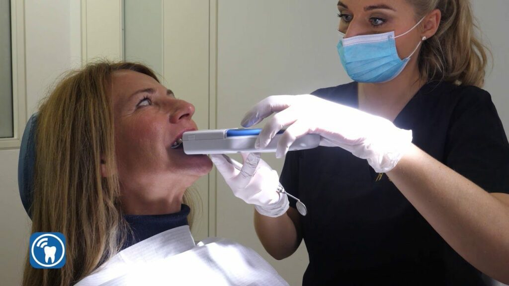 Occlusense Bausch Articulating Paper